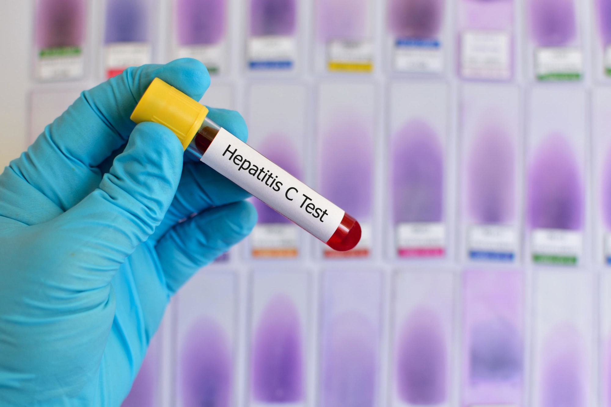 La Secretaría de Salud emite recomendaciones para evitar la hepatitis