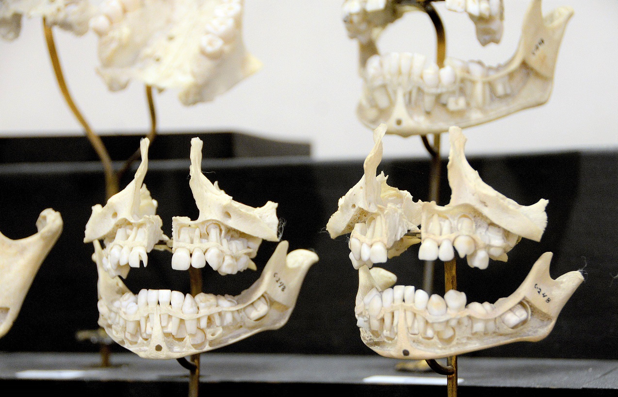 La dentadura es testigo confiable para identificar cuerpos.