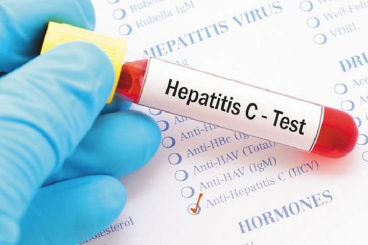 600 mil mexicanos son portadores del virus de hepatitis C; sólo el 20% lo sabe.