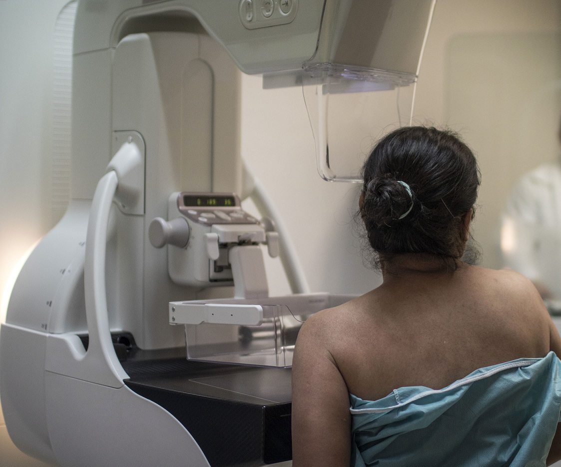 Invitan a mujeres a realizarse la mastografía para prevenir el cáncer de mama.