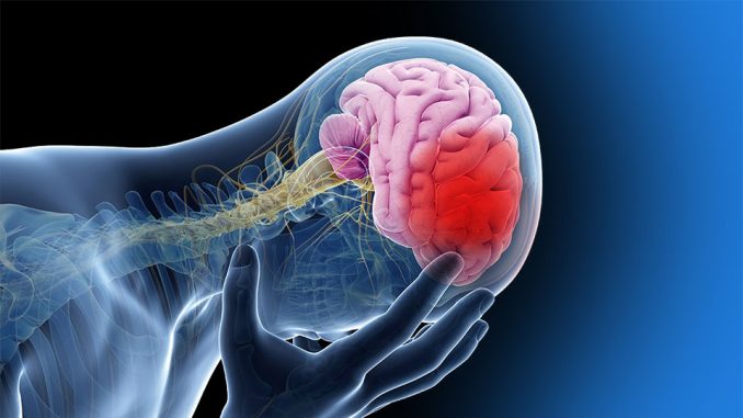 Universitarios mejoran funcionalidad de personas que sufrieron enfermedad vascular cerebral. Foto: Internet.