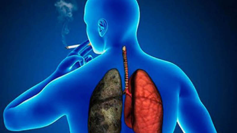 Enfermedades pulmonares agravan lucha contra COVID-19