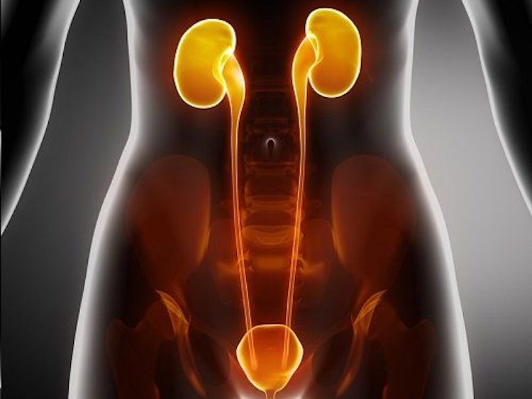 4 principales complicaciones por infecciones de las vías urinarias.