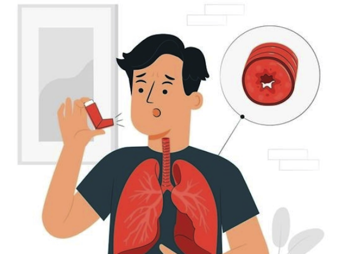 73% de las personas con asma no están diagnosticadas.