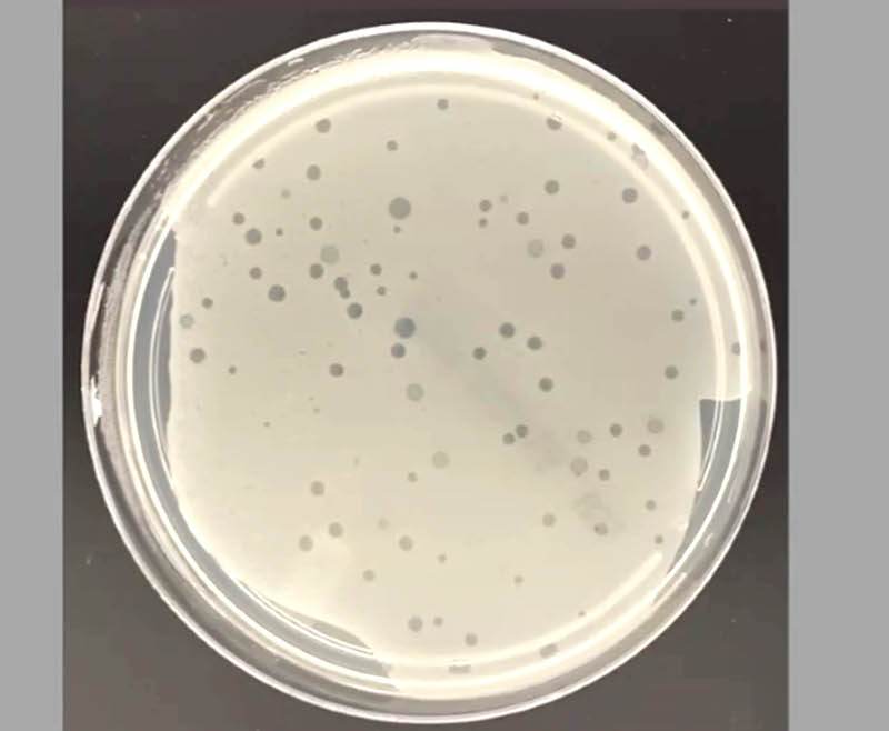 Con virus "depredadores" científicos UNAM buscan combatir bacterias resistentes a los antibióticos.